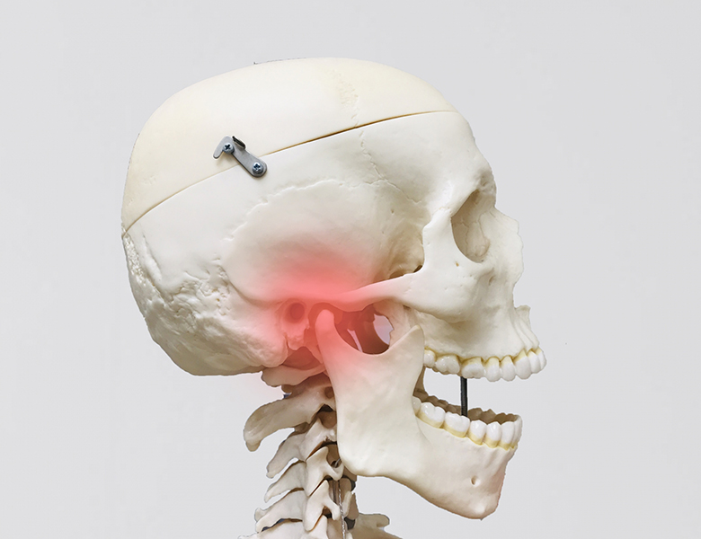 東京駅（京橋駅）徒歩2分の歯医者、精密根管治療、村岡歯科医院で顎関節症