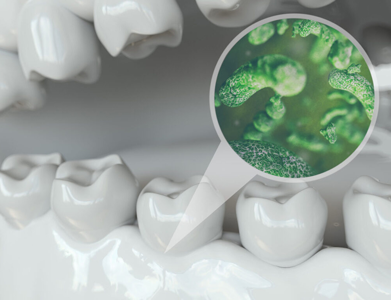 東京駅（京橋駅）徒歩2分の歯医者、精密根管治療、村岡歯科医院で歯周病治療