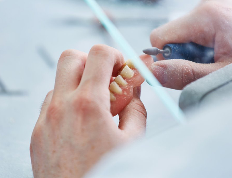 東京駅（京橋駅）徒歩2分の歯医者、精密根管治療、村岡歯科医院の入れ歯治療