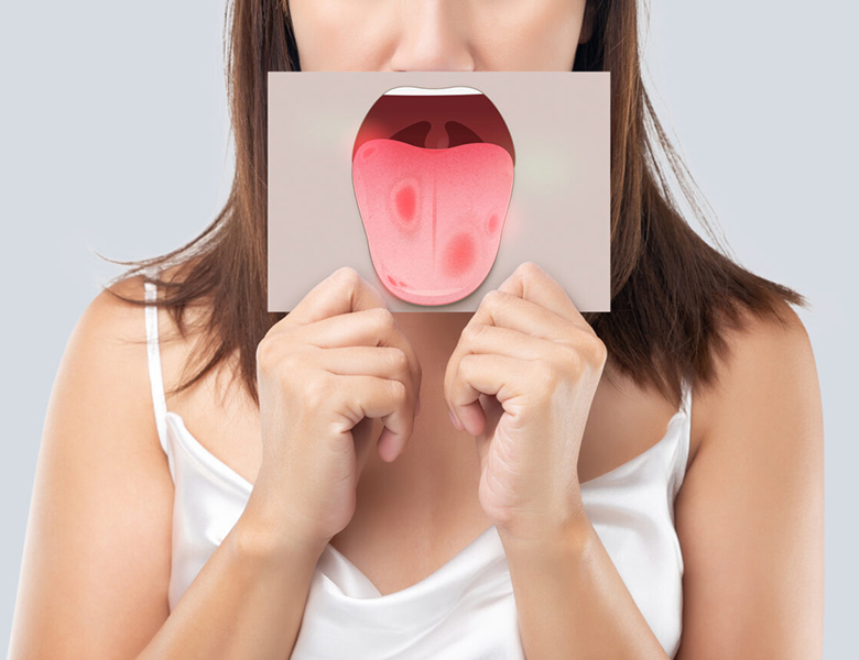 東京駅（京橋駅）徒歩2分の歯医者、精密根管治療、村岡歯科医院でお口の中のデキモノ