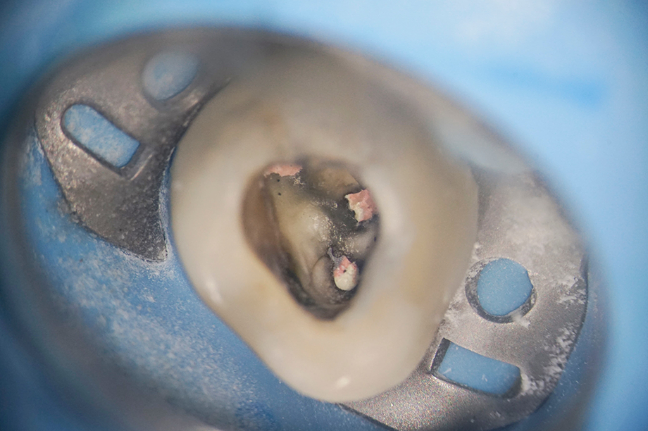 東京駅（京橋駅）徒歩2分の歯医者、精密根管治療、村岡歯科医院のVRで体感する新しい歯科医療